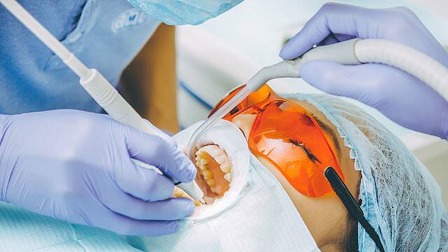 Postupak izbjeljivanja zuba u stomatološkoj ordinaciji